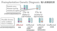 植入前遗传学诊断（PGD）技术原理