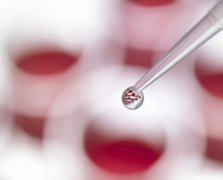 三代试管婴儿技术筛查血友病基因